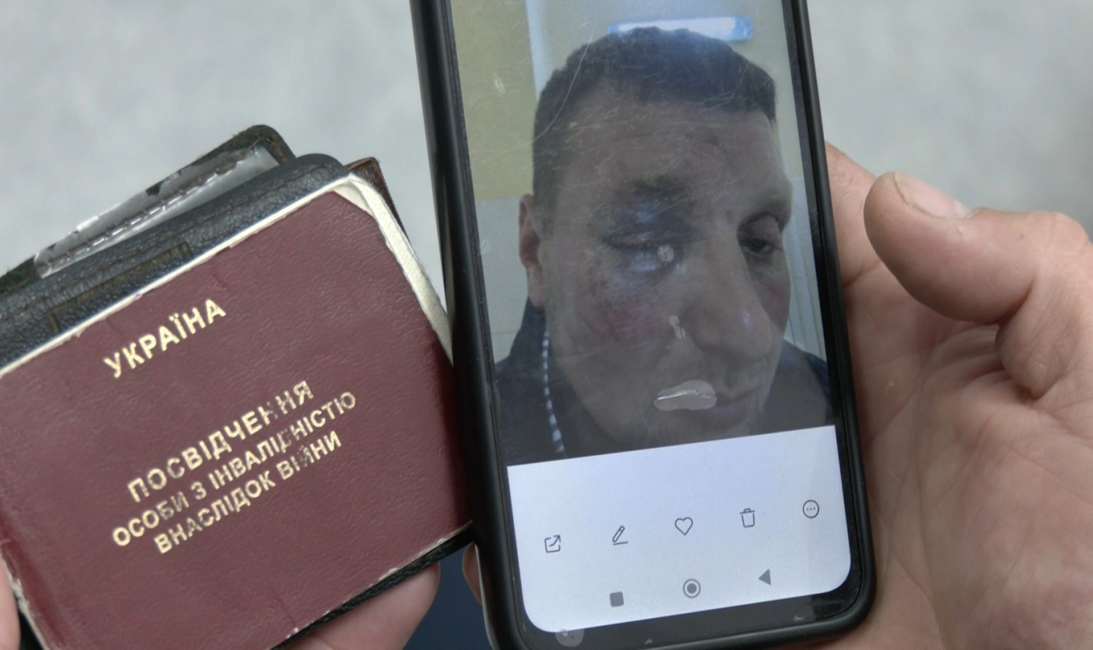 Інцидент на Володимирській: поліція Волині розслідує справу про побиття ветерана у Луцьку